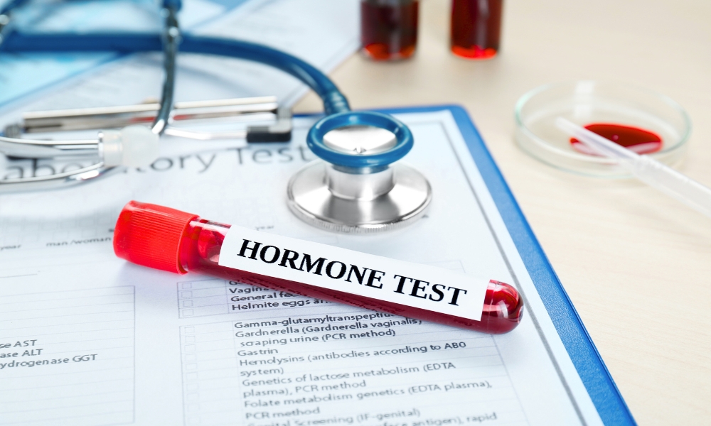 hormonski disbalans
