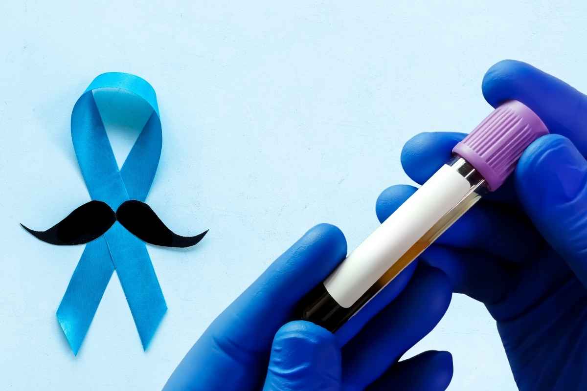 psa test u ruci i plavi znak za kancer sa brkovima, na plavoj pozadini